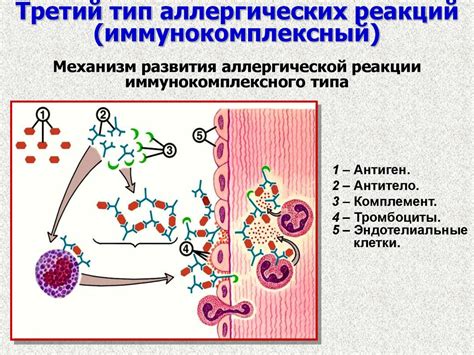 Избегайте аллергических реакций