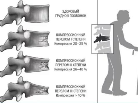 Избегание повторных травм