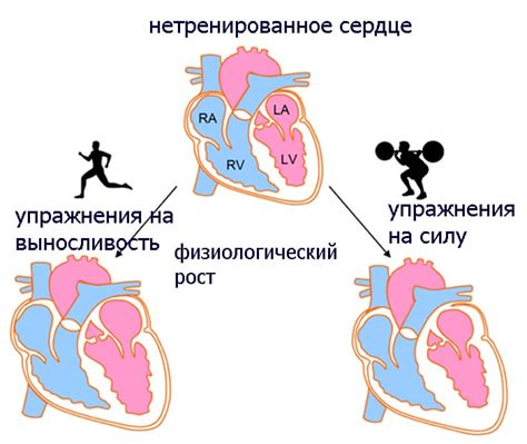 Излишние физические нагрузки: фактор расширения стенок сердца