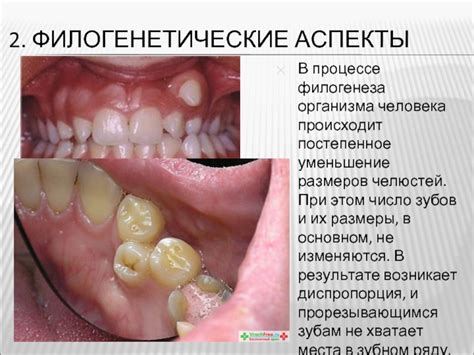 Изменения в зубном ряду в процессе старения