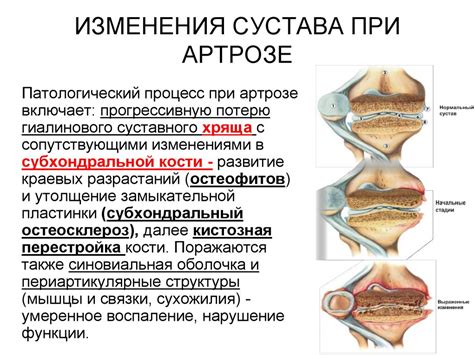 Изменения конгруэнтного сустава при патологиях