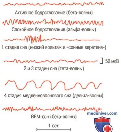 Изменения настроений и сна