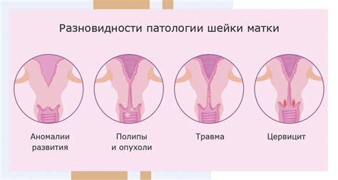 Изучаем разновидности серых цветов шейки матки