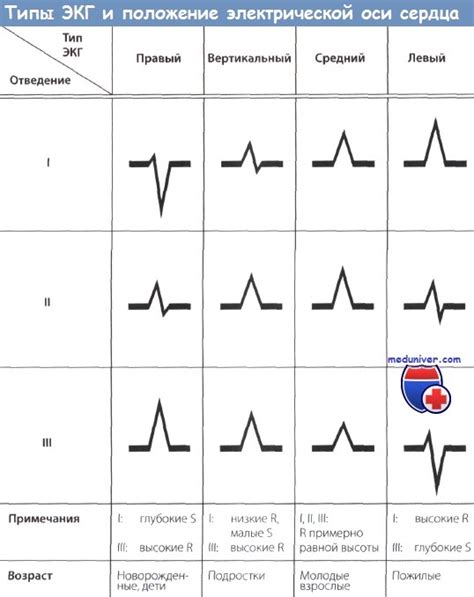 Изучение промежуточной электрической позиции сердца у детей