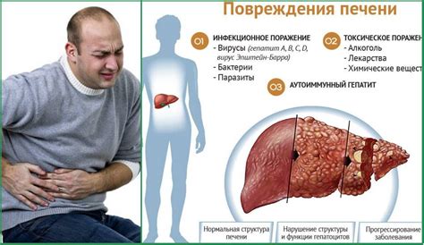 Инвазия печени: симптомы и причины