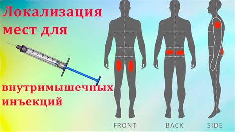 Индикации для гепариновых уколов в плечо