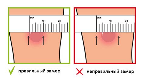 Интерпретация результатов манту 12мм