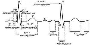 Интерпретация результатов электрокардиограммы