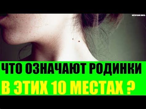 Интерпретация родинок