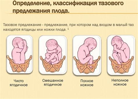 Интерпретация снов о движении ребенка внутри матки с позиции психологии