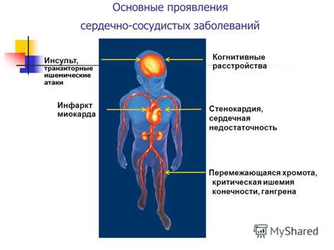 Инфузии: важные методы лечения