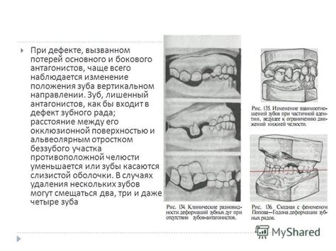 Исторические факторы и символика сновидения о дефекте зуба