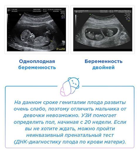 История УЗИ пола ребенка: открытие и развитие метода