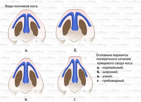 История изучения раздвоенности кончика носа