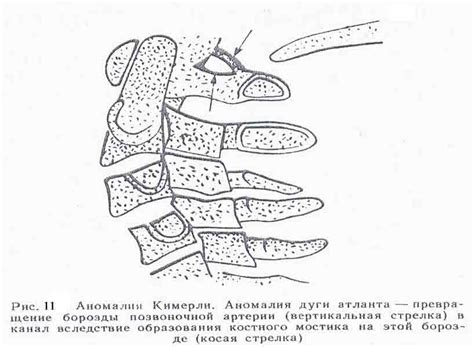 История и происхождение сплетения рук