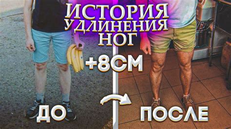 История скрещивания ног