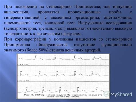 Ишемический тест: суть методики