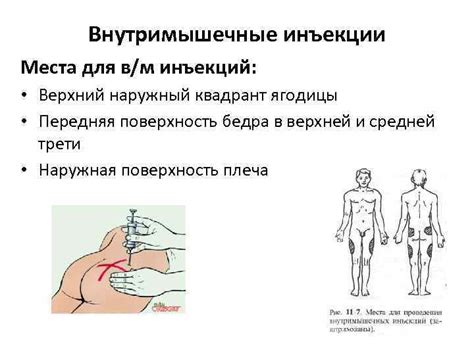 Какая методика введения препаратов является парентеральной?