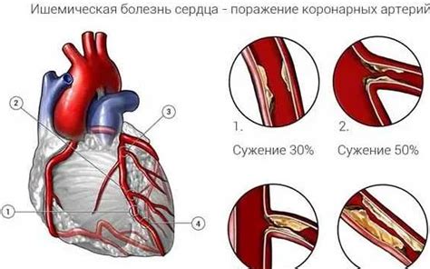 Какая роль играет наследственность в развитии синусной брадикардии у женщин