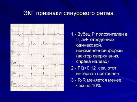 Какие болезни могут быть связаны с нарушением синусового ритма?