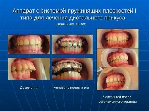 Какие есть основные методы лечения ортодонтической патологии?