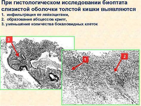 Какие заболевания могут быть выявлены при гистологическом исследовании биоптата кожи?