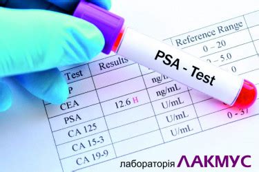 Какие заболевания могут вызывать высокий показатель ПСА 500