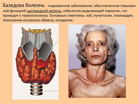 Какие заболевания связаны с периферическими железами?