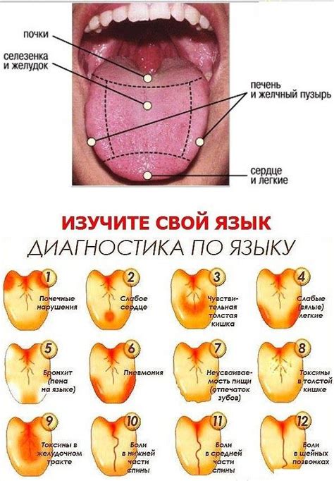 Какие инфекции могут привести к прыщикам на языке