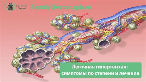 Какие медикаментозные методы применяются в лечении незначительной легочной гипертензии?