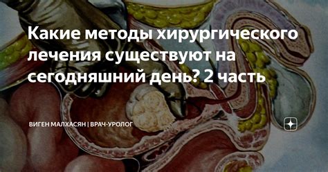 Какие методы лечения микроангиоэнцефалопатии существуют?