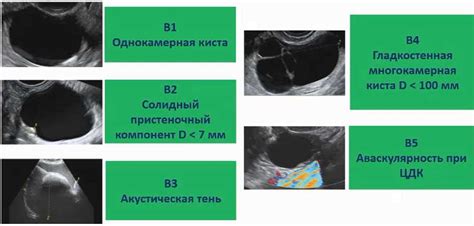 Какие методы лечения применяются при неоднородности миометрия?