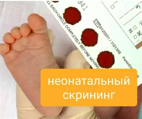 Какие особенности имеет скрининг МОМ для беременных?