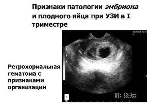 Какие последствия возникают при деформации плодного яйца?