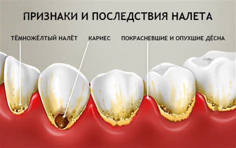 Какие последствия могут быть, если тебя опустят?