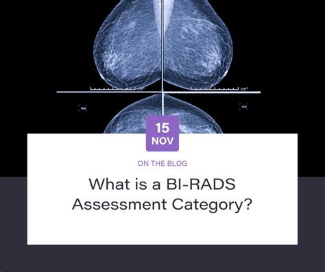 Какие признаки указывают на BI-RADS 2?