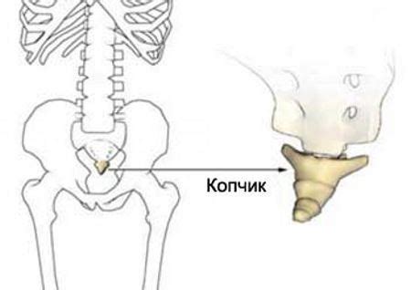 Какие причины возникновения острого копчика?