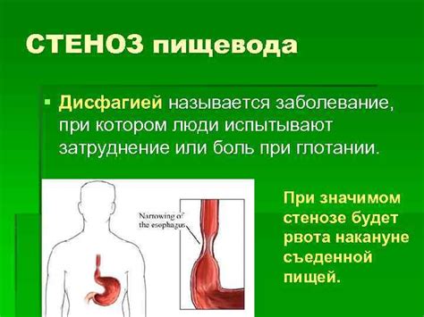 Какие причины короткого пищевода?