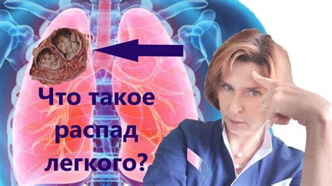 Какие проблемы вызывает распад легкого?