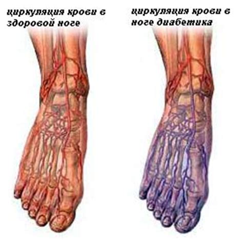 Какие проблемы могут возникнуть при холодных ногах?