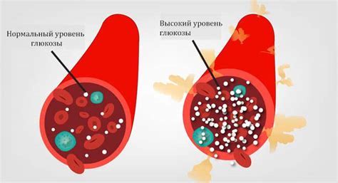 Какие проблемы может вызвать повышенный уровень глюкозы?