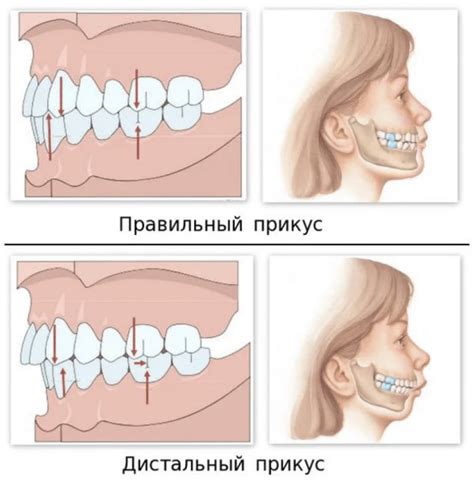 Какие проблемы с прикусом и зубами может решить ортодонт?