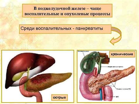 Какие процессы происходят в поджелудочной железе?