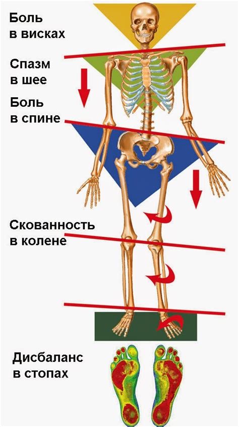 Какие симптомы возникают при перекосе таза?