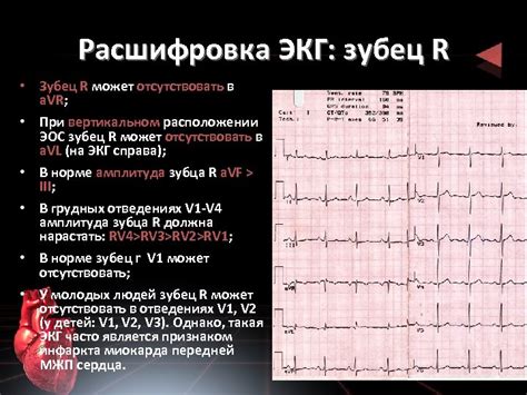 Какие симптомы и признаки сопровождают блокаду на кардиограмме?