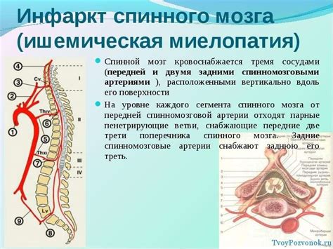 Какие симптомы может проявлять миелопатия спинного мозга?