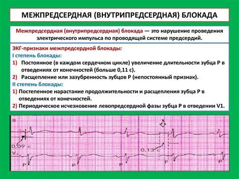 Какие симптомы свидетельствуют о нарушении желудочковой проводимости сердца?