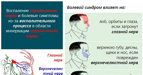 Какие симптомы свойственны невралгии и как их можно определить