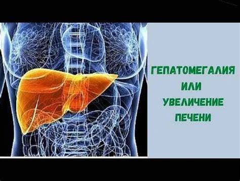 Какие симптомы сопровождают гепатомегалию у ребенка?