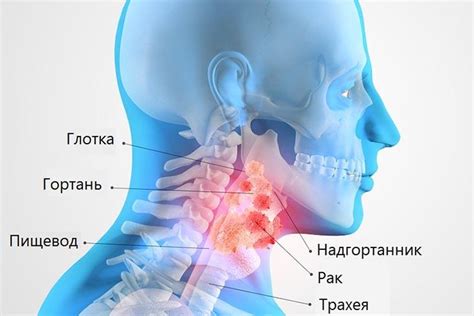 Какие симптомы сопутствуют опуханию горла